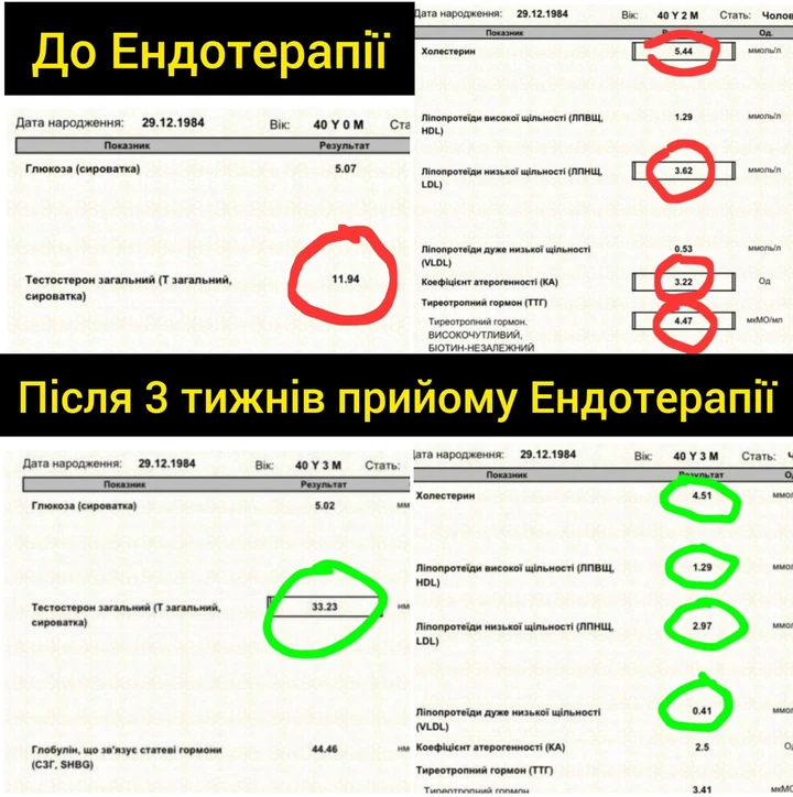 Приклад 3: наданий колаж аналізів до та після
